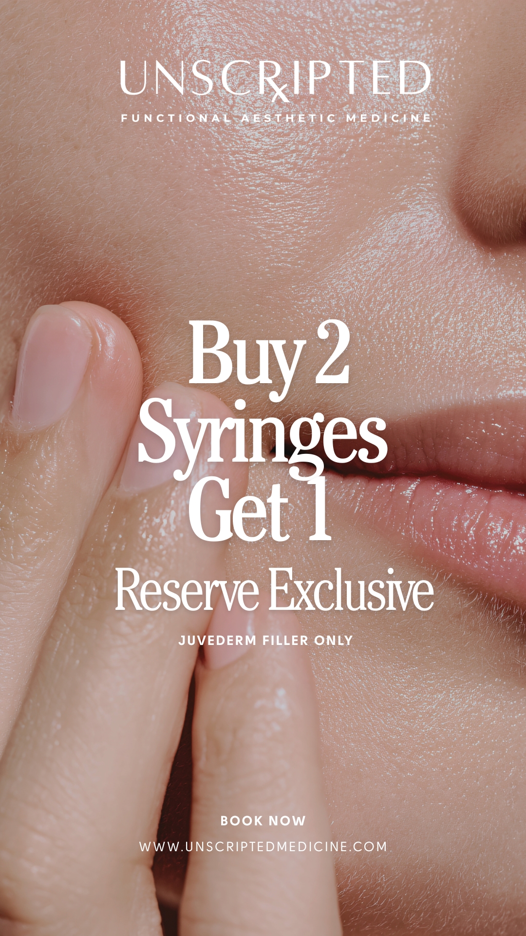 Reserve Exclusive — Buy 2 Syringes Get 1 Free, Juvederm filler only