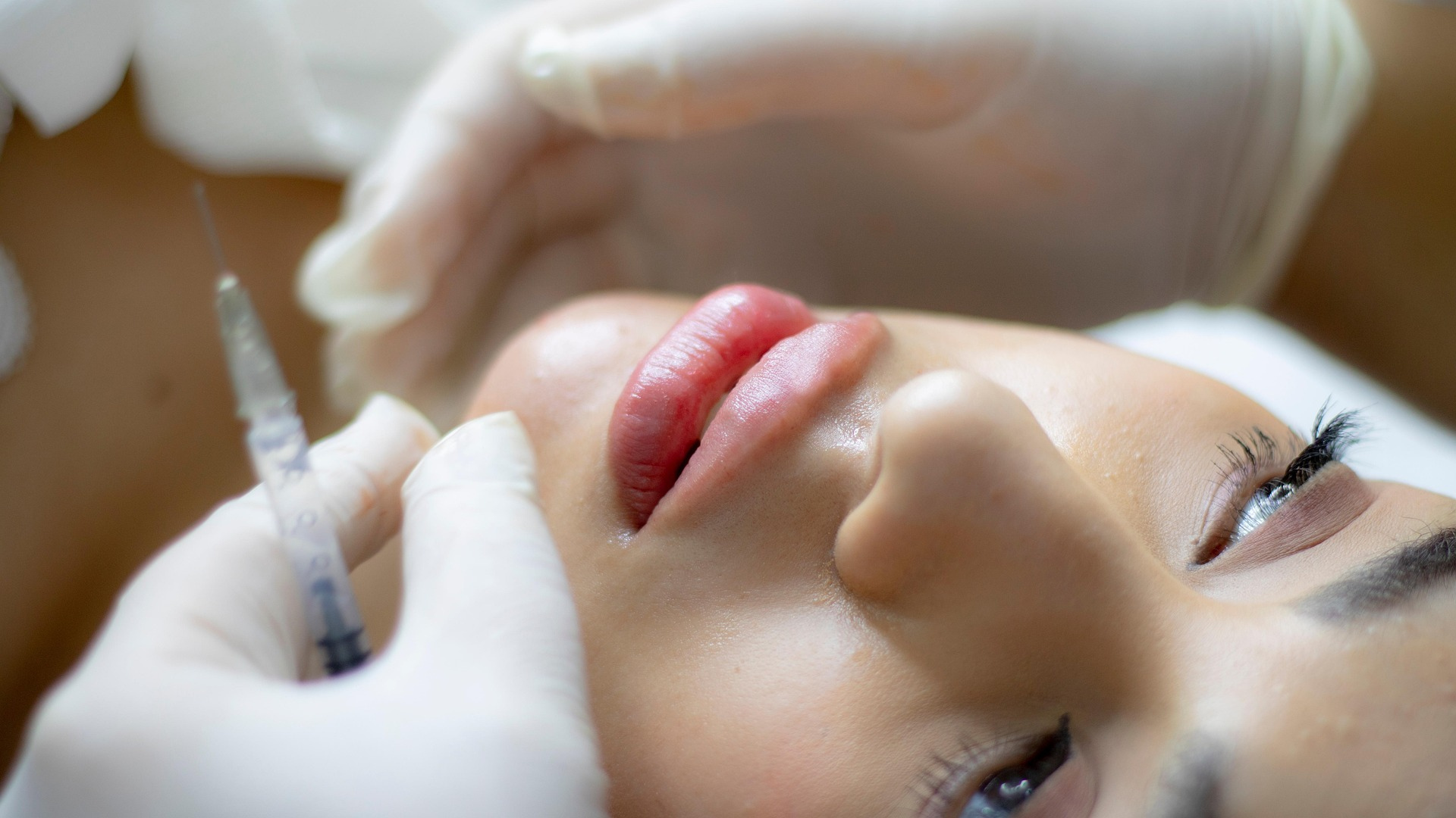 The Natural Look — How to Avoid the 'Overdone' Filler Effect