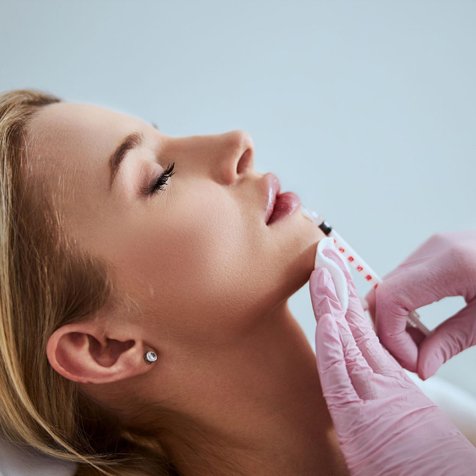 How Many Units of Botox Do I Need? Real Numbers by Area