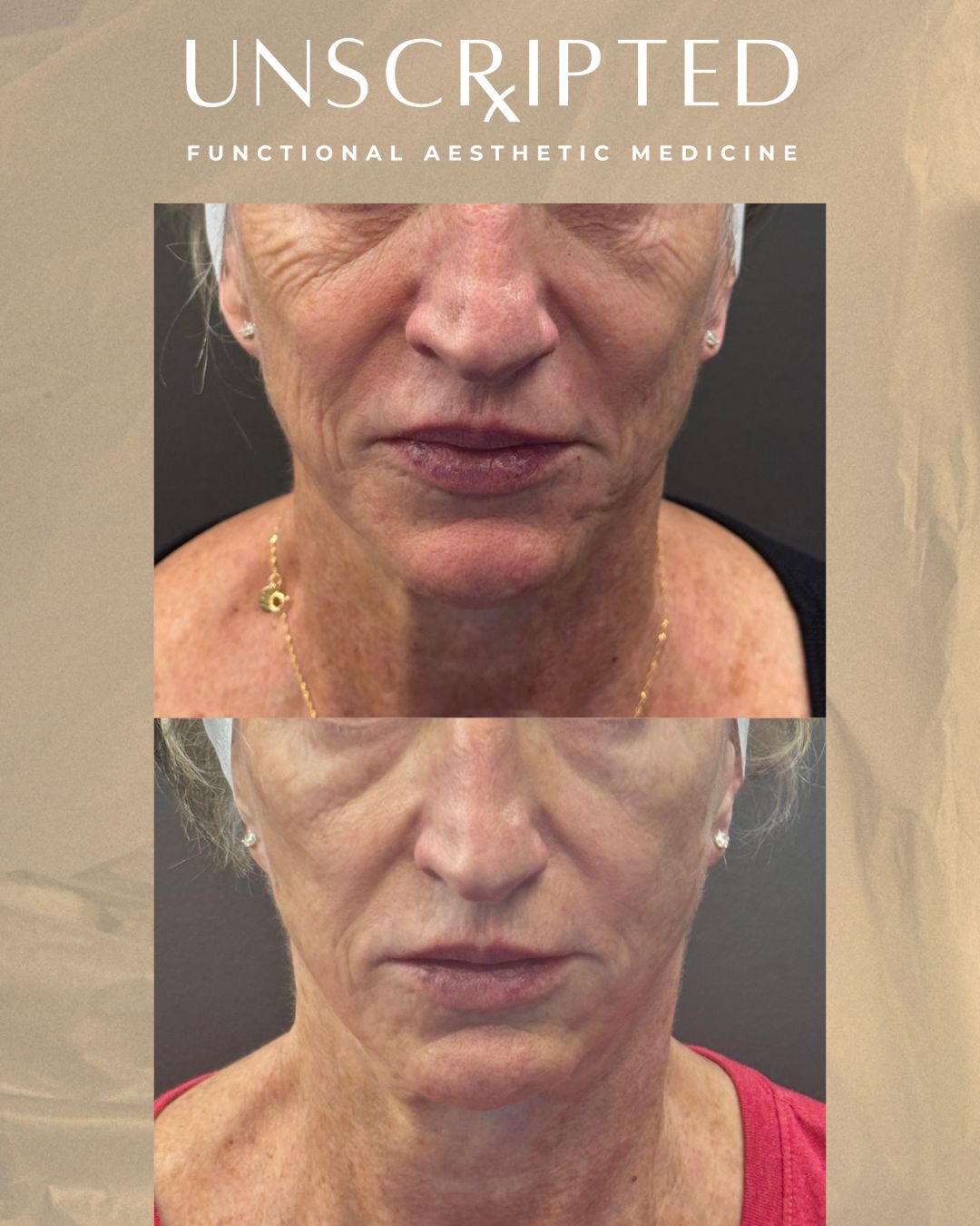 PRX Plus: Why Combining Treatments Often Delivers Better Skin Results